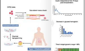事关糖尿病治疗，我国科学家取得突破